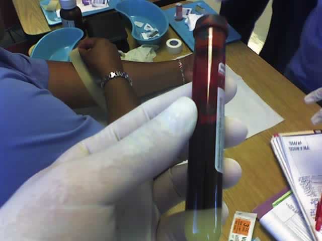 Tubes Heparinés
